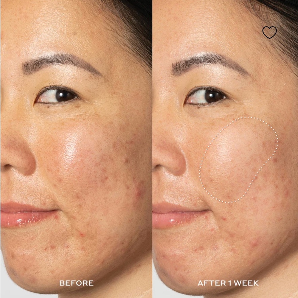 Ole Henriksen Dark Spot Toner - Picture 8 of 11